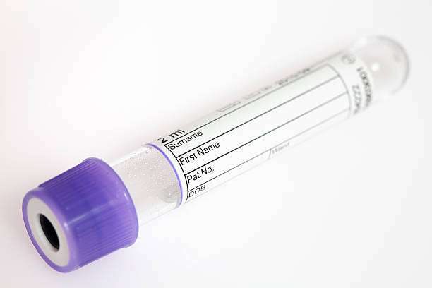 Purple vial on gray background