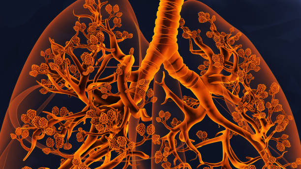 der bronchialbaum und die lungenbläschen in den menschlichen atemwegen - human lung alveolus respiratory system blood stock-fotos und bilder