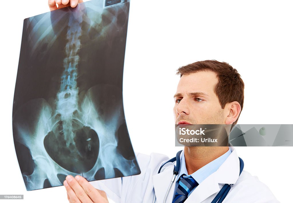 중 일체의 손상 또는 골절 - 로열티 프리 X-레이 스톡 사진