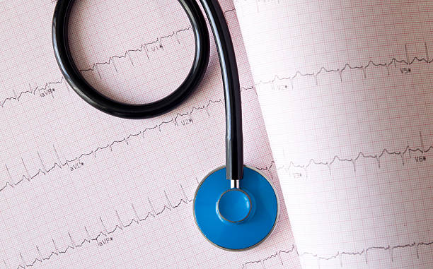 istock Stethoscope and charts with heart ecg graph 176412204