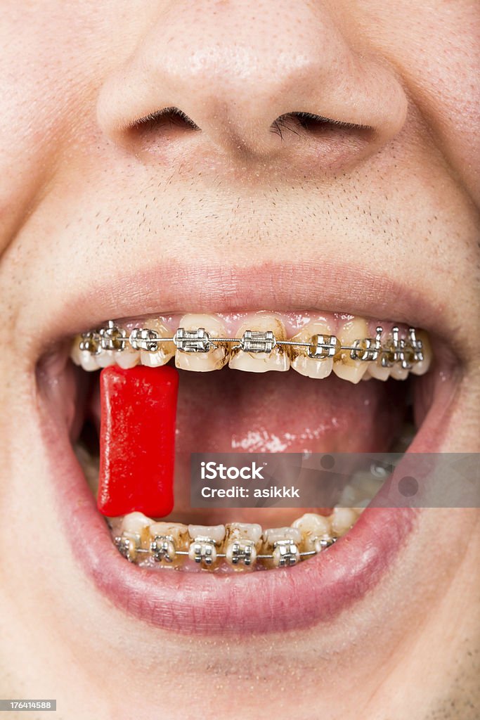 Fil dentaire - Photo de Dentition humaine libre de droits
