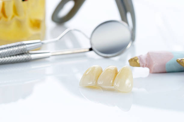 istock Macro of prosthetic teeth with dental tools 176431248