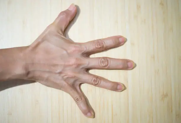 Photo of close up of a female hands holding her fingers