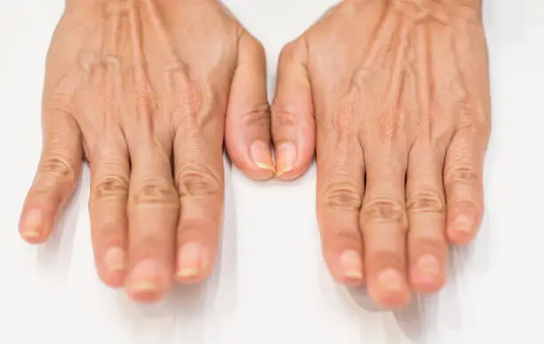 Photo of close up of a female hands holding her fingers