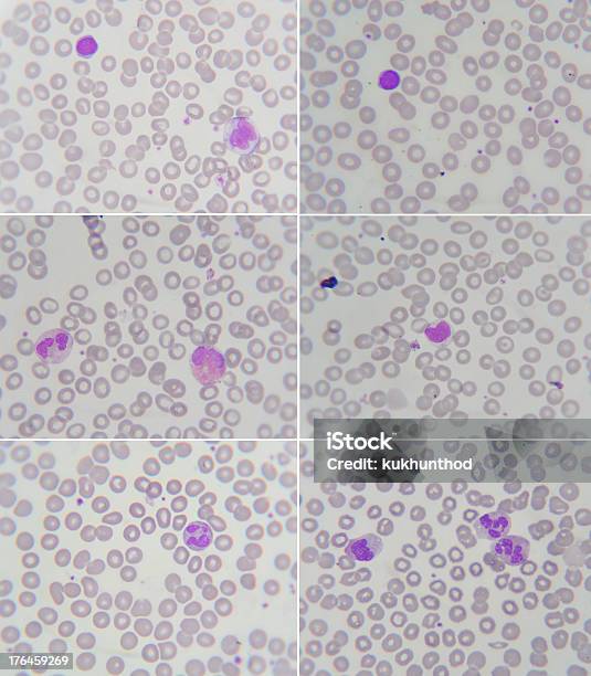 Package Für Menschliches Blut Smear Stockfoto und mehr Bilder von Malariaerreger - Malariaerreger, Arbeitszimmer, Basophil