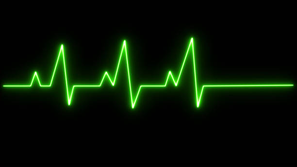 istock Green Heart pulse light transparent effect, electrocardiogram. Neon light line template. 1765015095