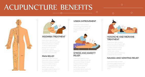 Poster about needle treatment and acupuncture, flat cartoon vector illustrations on template. Banner with information, benefits oriental alternative medicine. Ancient traditional Asian practice.