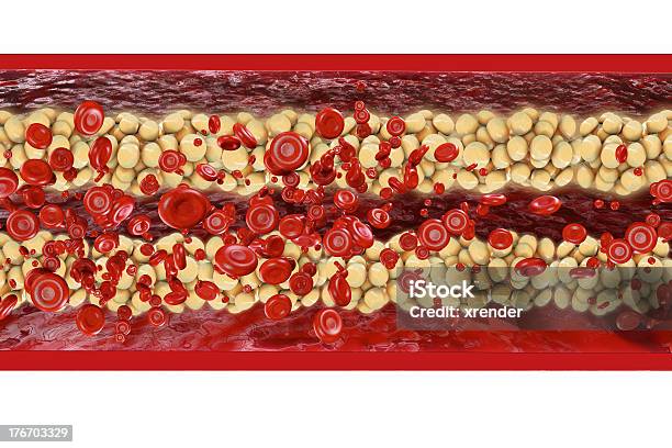 Cholesterol 3d Rendered Illustration Stock Photo - Download Image Now - Calcification, Blood Pressure Gauge, Stroke - Illness