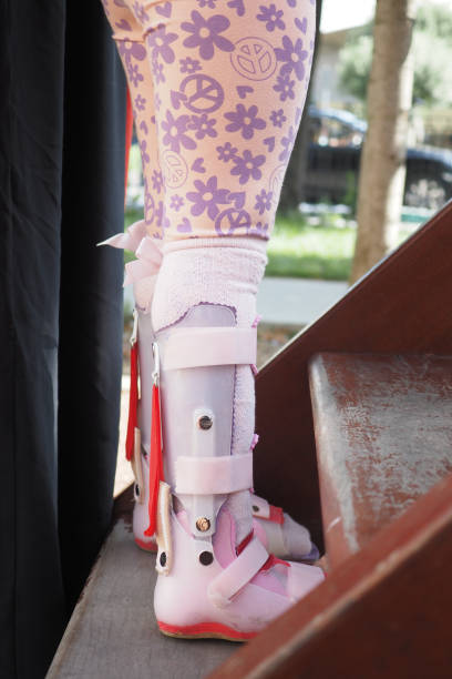 istock Child cerebral palsy disability, legs orthosis. 1767333630