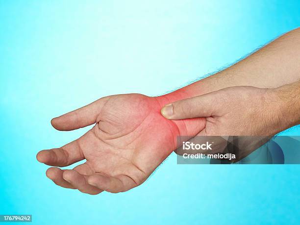 Akute Schmerzen In Palm Der Hand Stockfoto und mehr Bilder von RSI-Syndrom - RSI-Syndrom, Anatomie, Arthritis