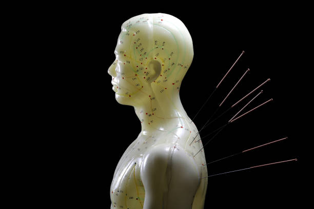 左肩に鍼を刺した男性の鍼灸模型 - acupoints ストックフォトと画像