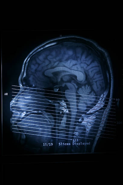 Profile MRI scan of human brain stock photo