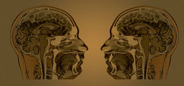 pm_mri - 2head - noggin foto e immagini stock