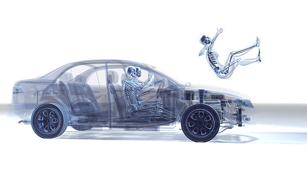 X-ray depiction of car accident stock photo