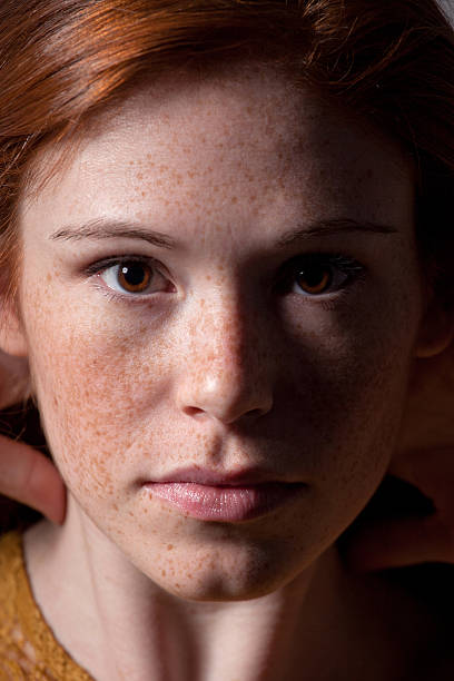 istock Sexy-Freckles 176893588