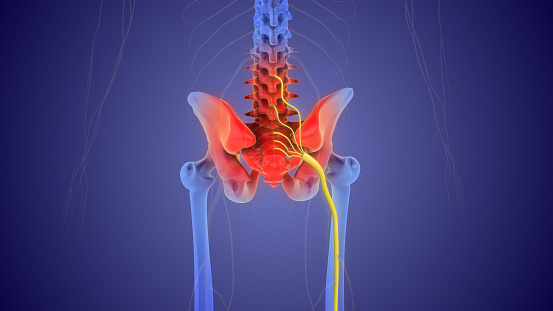 Pain radiating along the sciatic nerve, which runs down one or both legs from the lower back.
It's usually caused when a herniated disc or bone spur in the spine presses on the nerve.
Pain originates in the spine and radiates down the back of the leg. Sciatica typically affects only one side of the body. Medication for pain and physiotherapy are common treatments.