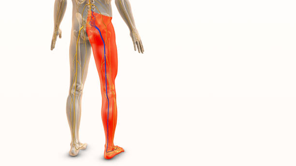 Medical concept for sciatic nerve discomfort