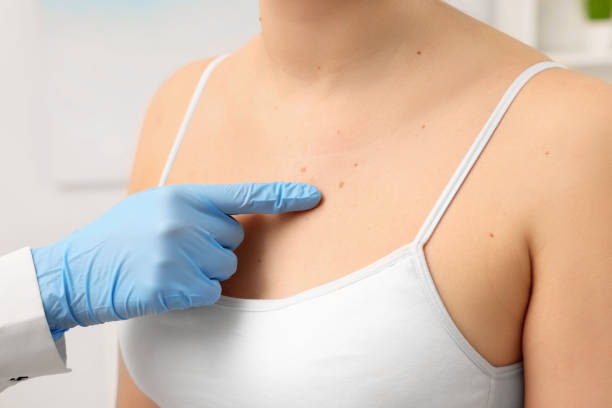 istock Dermatologist examining patient's birthmark indoors, closeup view 1769780547