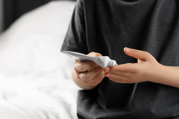 child applying ointment onto hand at home, closeup. space for text - primary care imagens e fotografias de stock