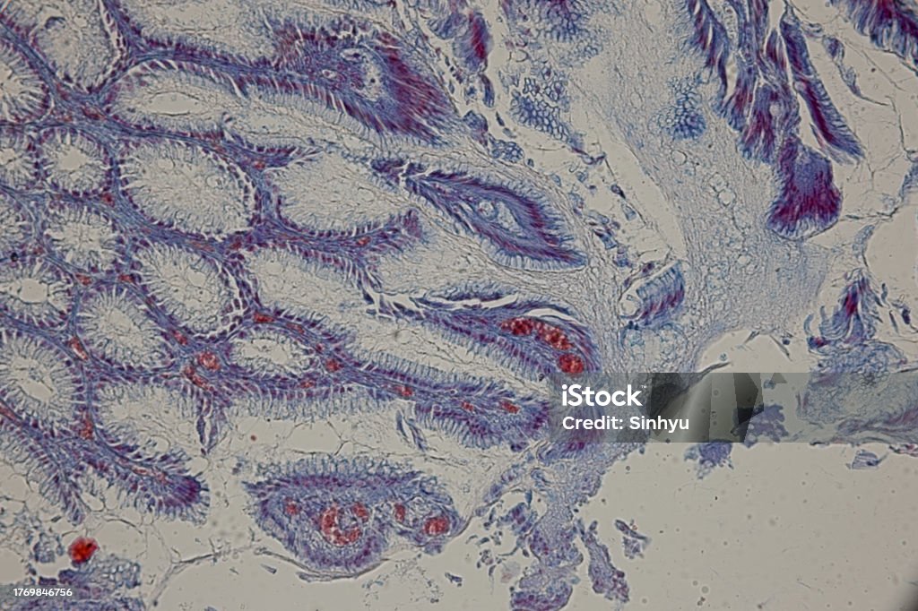 Microscope Tissue Paper Type Of Tissue Human Under The Microscope In Lab Stock Photo - Download ...