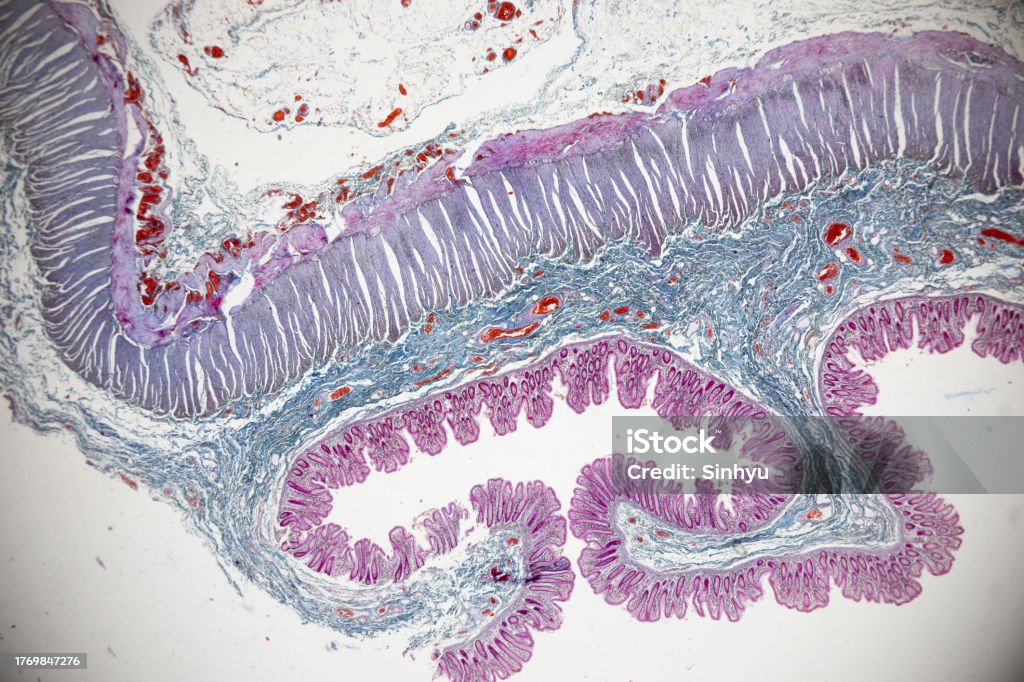 Microscope Tissue Paper Type Of Tissue Human Under The Microscope In Lab Stock Photo - Download ...