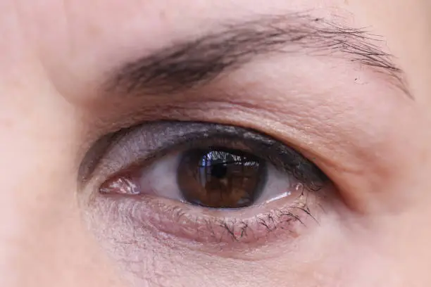 Photo of Eye of adult woman with dark brown iris and hanging eyelid