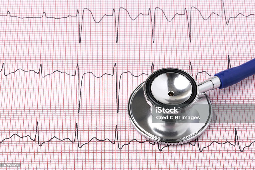 ECG printout and stethoscope Photo of an electrocardiogram ECG or EKG printout with stethoscope Beauty Stock Photo