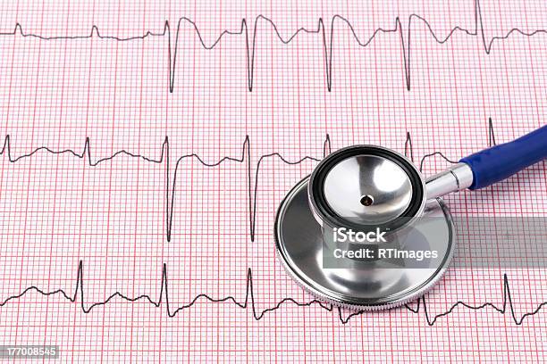 Ecg Printout And Stethoscope Stock Photo - Download Image Now - Beauty, Chart, Copy Space