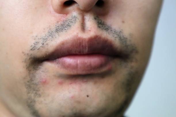 istock Close-up of a bearded Japanese man 1770136074