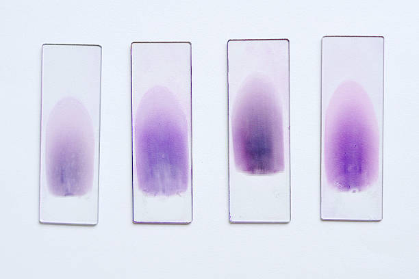 Laboratory slides of blood tests with purple stains A stained blood film waiting for analysis by microscope microscope slide stock pictures, royalty-free photos & images