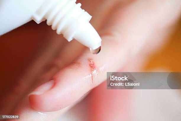 Disinfect The Scratch By Rubbing In Alcohol Stock Photo - Download Image Now - Wound, Adult, Assistance