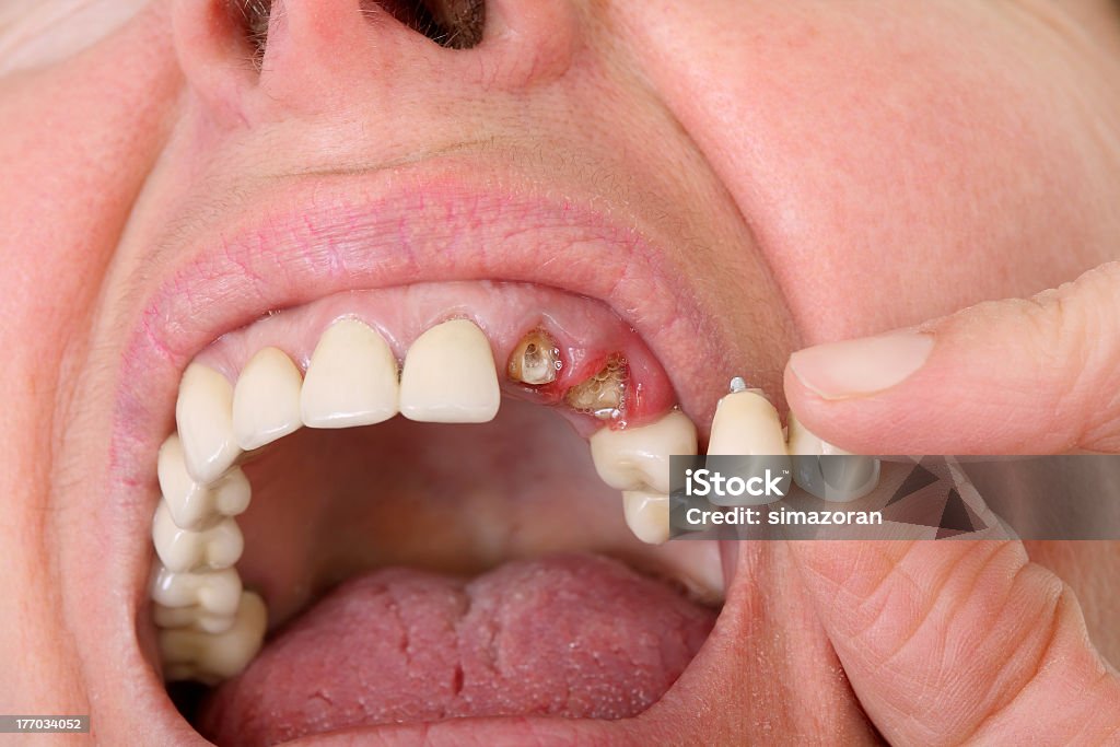 Dentista - Royalty-free 30-39 Anos Foto de stock