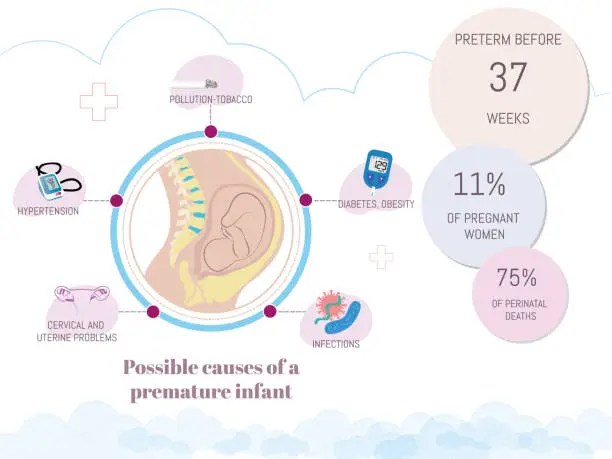 Vector illustration of Possible causes of premature pregnancy.