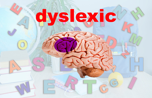 Neural Signature in human brain for Dyslexia, Disruption of Posterior Reading System on blue background, concept of dyslexia awareness, learning difficulties, human brain development, science