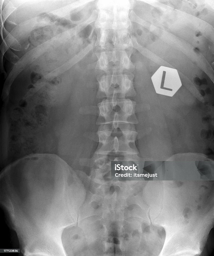 La radiografía de la columna vertebral. - Foto de stock de Asistencia sanitaria y medicina libre de derechos