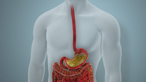 istock Acid Reflux GERD Disease Illustration 1771244567