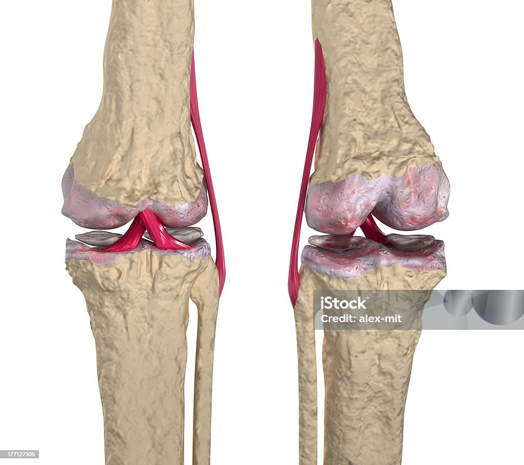Остеоартрит: Коленного сустава с связки и подвернутые cartilages - Стоковые фото Здравоохранение и медицина роялти-фри