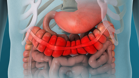 Irritable Bowel Syndrome IBS Gut Pain 3D