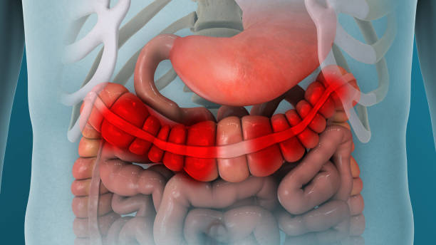 síndrome del intestino irritable dolor intestinal - cramping fotografías e imágenes de stock