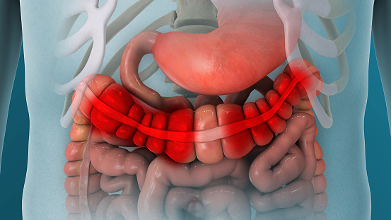Irritable Bowel Syndrome IBS Gut Pain 3D