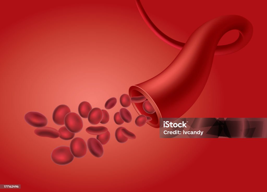 人間の血管 - 貧血のロイヤリティフリーベクトルアート