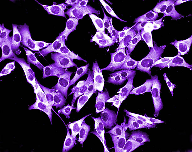 Melanoma Cancer Cell stock photo