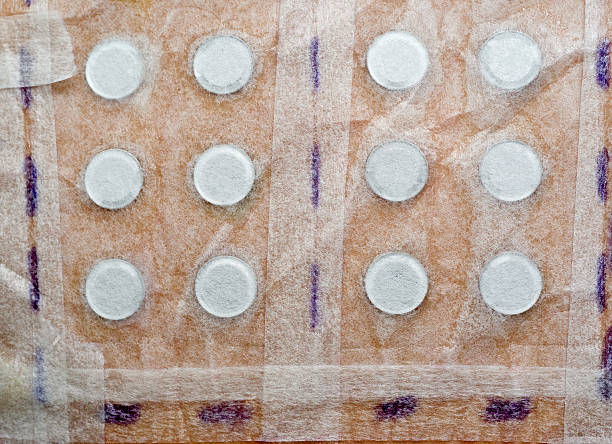 Skin Allergy Patch Test Close up on Back of Patient