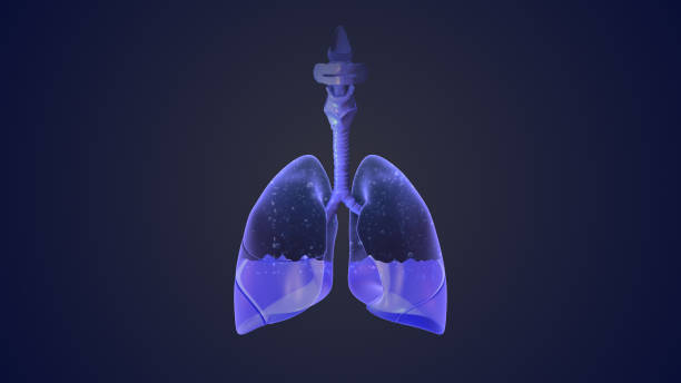 istock Pleural effusion represents inadequate disposal 1772711994