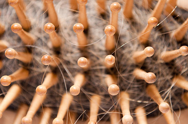 Escova de Cabelo com perda de cabelo - fotografia de stock