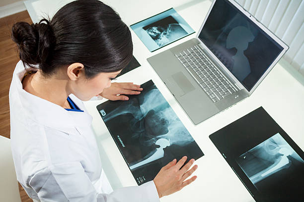 Female Woman Hospital Doctor Looking at X-Rays & Laptop An Asian Chinese female medical doctor looking at x-rays of hip replacement and using laptop in a hospital hip replacement stock pictures, royalty-free photos & images