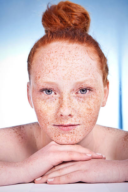 Lovely freckled girl stock photo