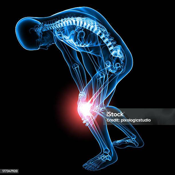 Dolor De La Rodilla Foto de stock y más banco de imágenes de Anatomía - Anatomía, Articulación, Articulación humana