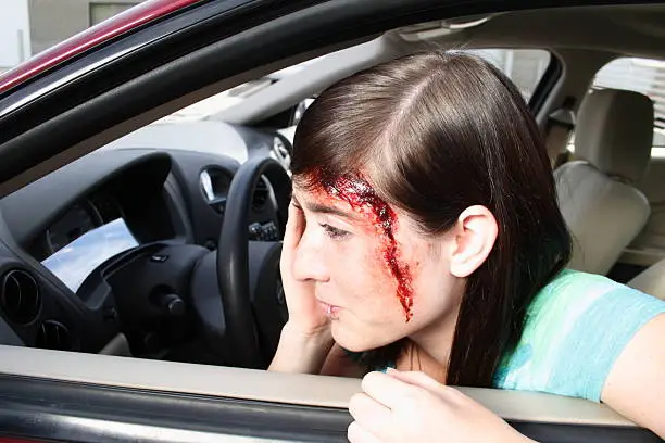 a teenaged female holds her head after an accident -  looking at herself in the car mirror