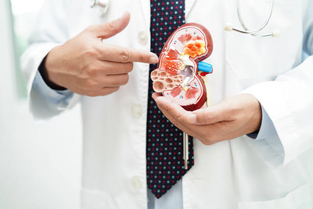 istock Chronic kidney disease, doctor with model for treatment urinary system, urology, Estimated glomerular filtration rate eGFR. 1773527880